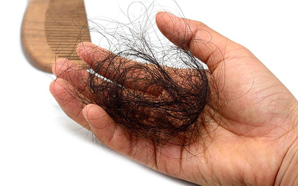 Tóc rụng nhiều